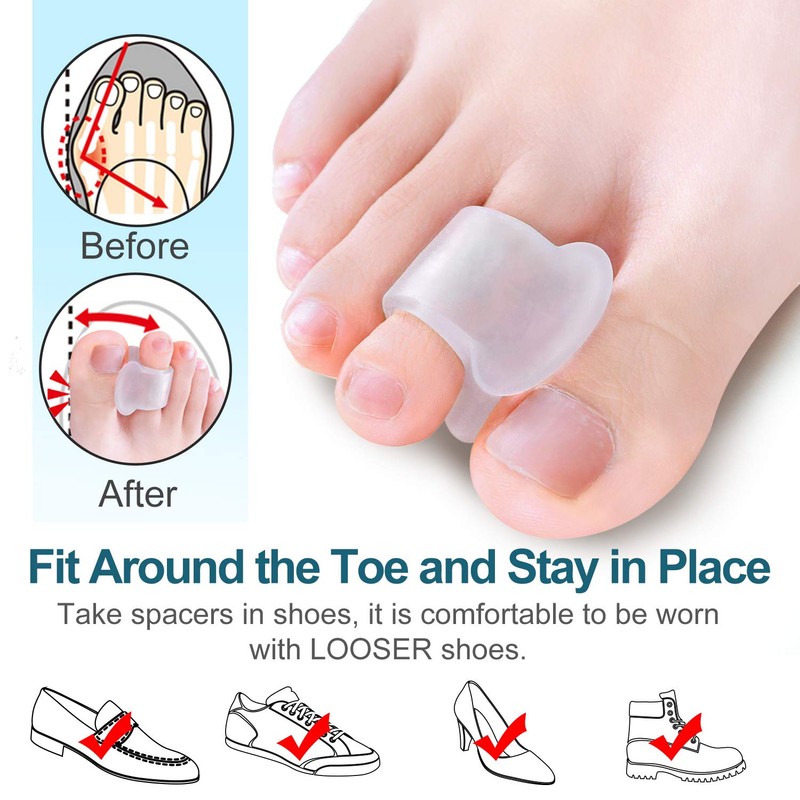 Povihome 10 Pack Clear Toe Spacers, Big Toe Separator (1st/2nd