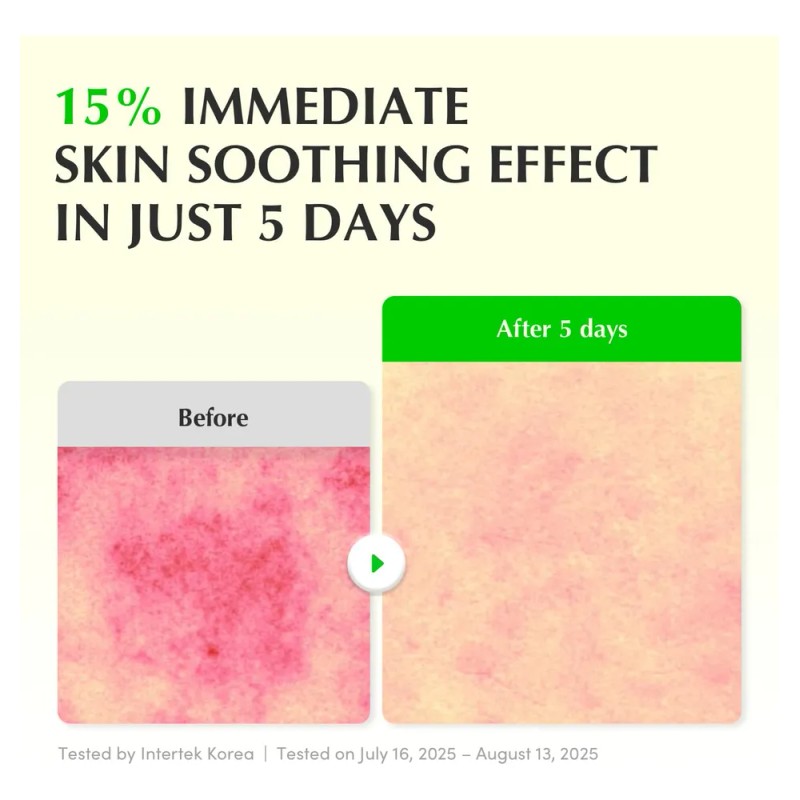 Eqqualberry Aloe Pdrn Suero Calmante Todo Tipo De Piel Día/noche