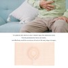 Ostomy Support Belt Stoma Hernia Belt, Ostomy Hernia Support Belt