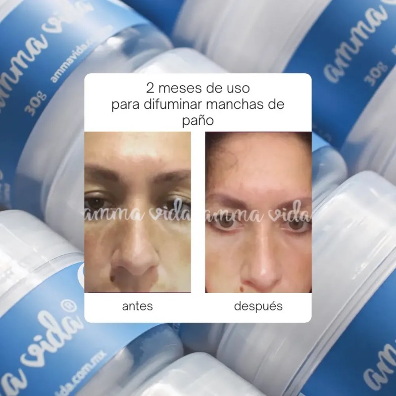 Crema Anti Manchas Amma Vida