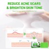 Jabón Facial Natural De Romero + Centella | Control Grasa