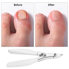 Toenail Trimmer, Toenail Clippers for Thick and Deep Ingrown Toenails and Fingernails, Stainless Steel Pedicure Toenail Cutter Nail Clippers, Non-Slip Handle (White)