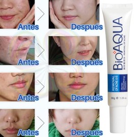 3pcs Crema Pure Skin Elimina Acné y Cicatrices Control De Grasa - 30gr c/u