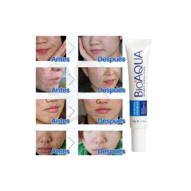 3pcs Crema Pure Skin Elimina Acné y Cicatrices Control De