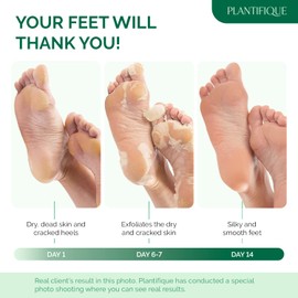 Plantifique Foot Peel Mask Foot Mask Dermatologically Tested Repair Heels & Removes Dry Dead Skin for Soft Baby Feet - Exfoliating Peel Mask for Hard Skin Peeling (Aloe Vera 2 Pack)