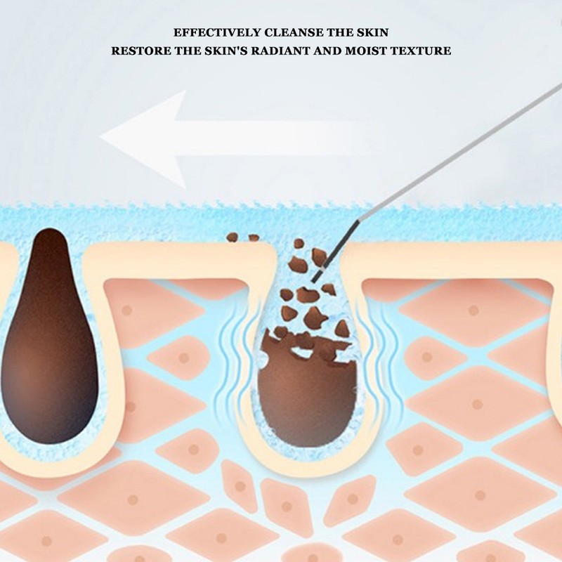 Household Ultrasonic Skin Scrubber Blackhead Removal Face Pore Cleanser InstrumentWhite
