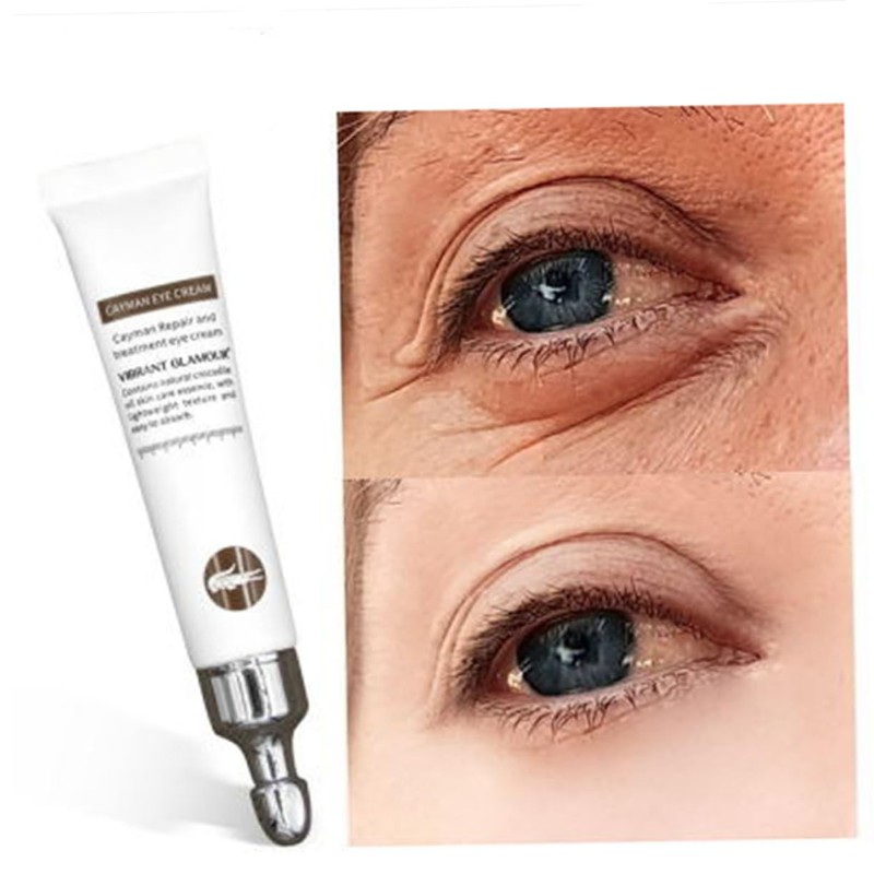 Healeved Dark Circle Eye Cream Essence Repair Anti-wrinkle Puffiness Moisturizing