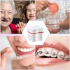2 PCS Denture Bath Cases Set, 2 Denture Storage Case