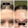 The pHix Philler Peptide Serum Duo - Daily Peptide Serum