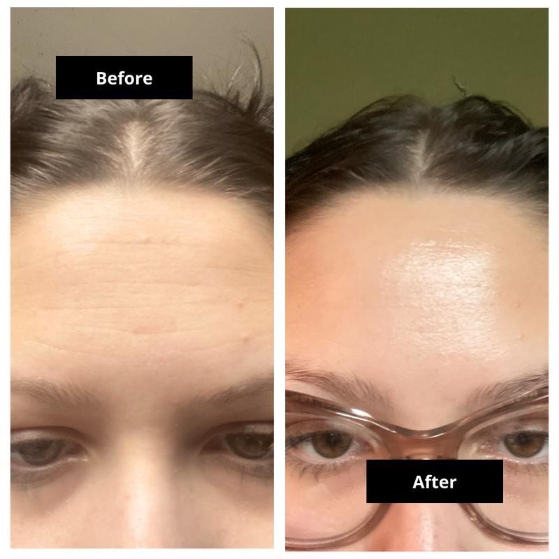 The pHix Philler Peptide Serum Duo - Daily Peptide Serum
