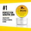 Sensitive Skin Balm - Uber Balm | Eczema & Psoriasis