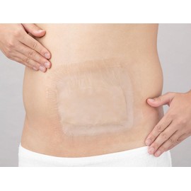 Alcare 20952 Bath Rack Seals, Pack of 10