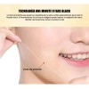 🔥 300 de colágeno absorbible de hilo de estiramiento facials