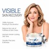 Vitamin K Cream- Moisturizing Bruise Healing Formula. Dark Spot Corrector