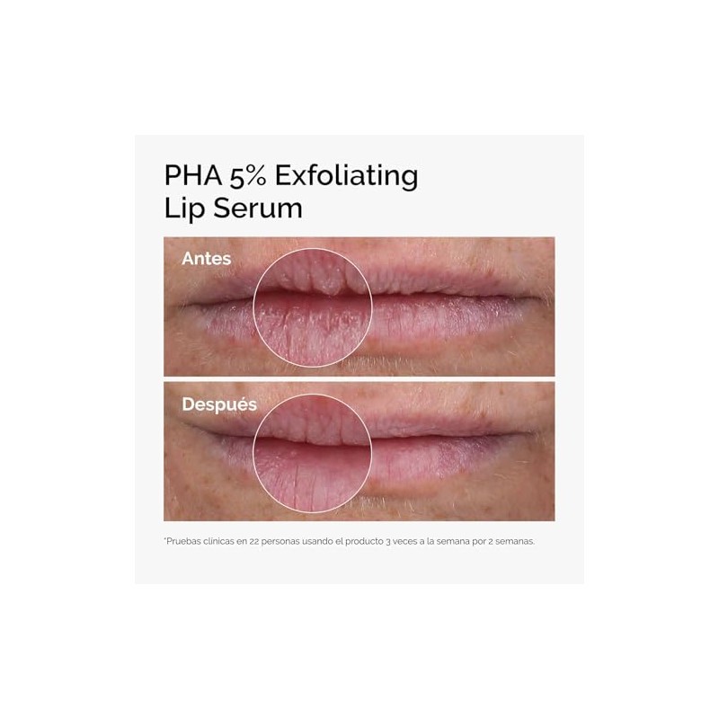 The Ordinary PHA 5 Exfoliating Lip Serum, tratamiento exfoliante e