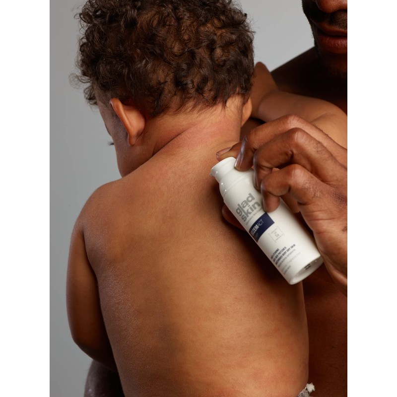 Gladskin Eczema Cream, 30 ml