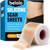 Láminas de silicona para cicatrices (rollo de 1,5 m x