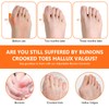1 Pair of Hallux Valgus Bandage, Hallux Valgus Shoes Women,