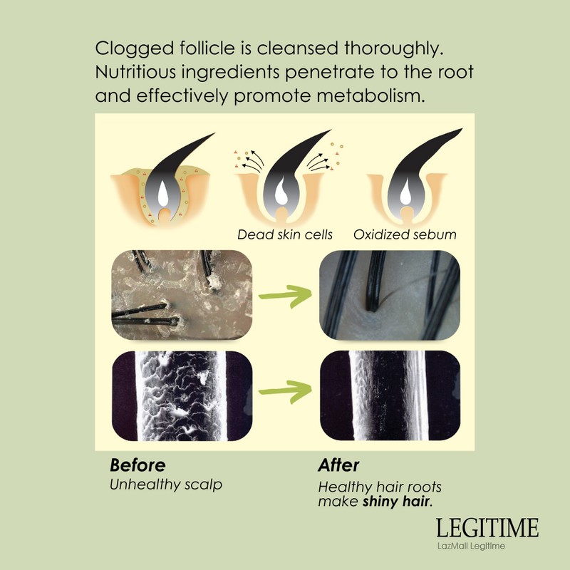 Legitime [KOREA] Legitime Scalp Air Tonic - Prevent Hair Loss