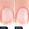 Lápiz Antimicótico Lunavia 3 Pzas 3 Ml Uñas Beige