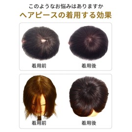 HIYE Whorl Partial Wig Artificial Skin Women Summer Mother's Day Part Wig Hairpiece Wig Hand Planted Silk Stealth Artificial Skin Hidden Gray Hair Thin Hair Top Cover, Chestnut