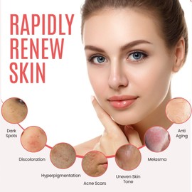 DERMAXGEN Dark Spot Corrector For Face and Body, Hyperpigmentation Treatment Uneven Skin Tone Corrector For Face, Body, Underarms, Knees, Elbows, Intimate Area, Inner Thigh for All Skin Types For Men Women - 1.7 FL OZ