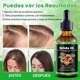 Aceite de Batana：60ML Aceite De Batana Para El Cabello-100% Puro y Natural para el Crecimiento del Cabello Rosemary for Hair Growth Reduce Hair Loss & Detox Your Scalp