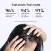Arata Intensive Hair Growth Serum - 30 ML | Boosts