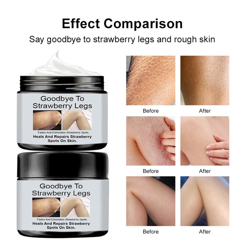 Strawberry Legs Treatment - Exfoliates & Moisturizes for Smooth Skin.