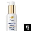 Dove Targeted Stretch Mark Serum: Reduces Dark Spots, Firms &