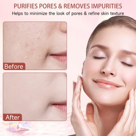 Purifying Exfoliating Gel, Gentle Exfoliating Gel for Face & Body, Face Facial Exfoliator Cleanser, Deep Cleansing and Moisturizing, for All Skin Types (2PCS)