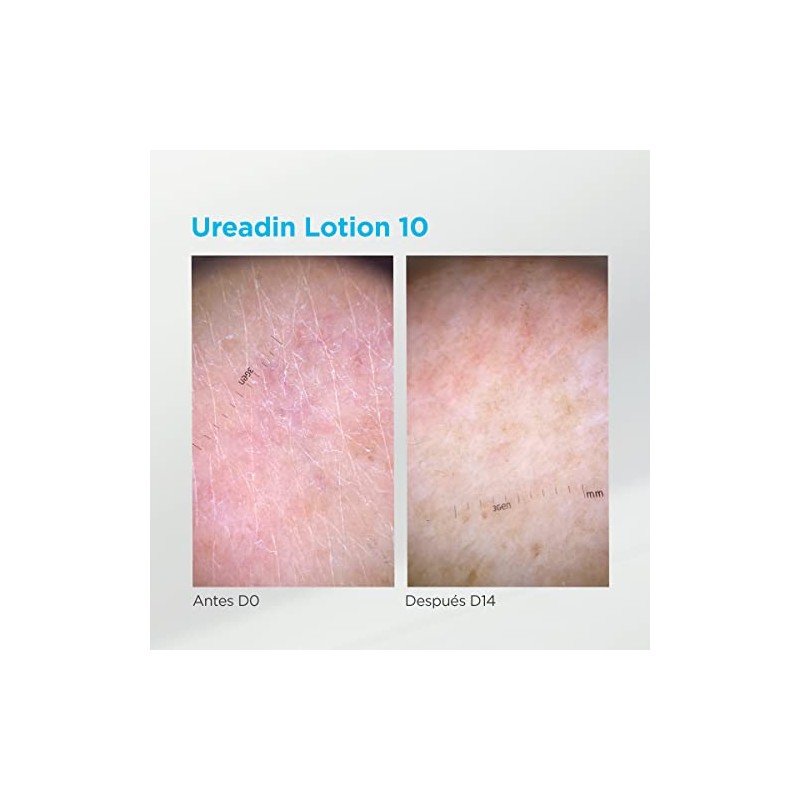 Ureadin Massage Oils 30 ml
