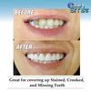 Instant Smile Comfort Fit Flex - Bright Shade - Upper