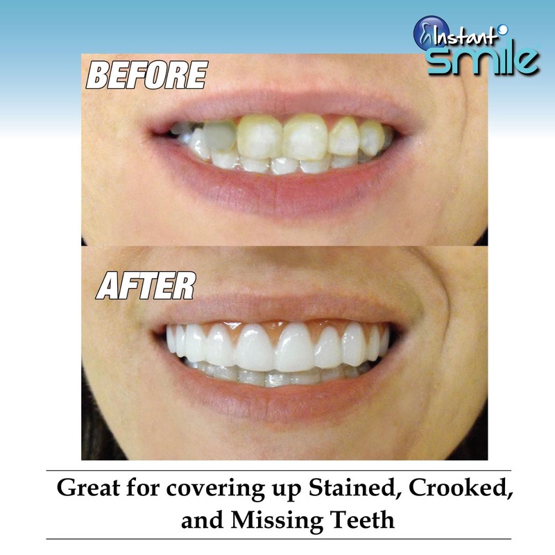 Instant Smile Comfort Fit Flex - Bright Shade - Upper