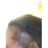 Miracle Hair Growth Serum