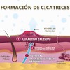 Scar Aid - Barra de silicona para tratamiento de cicatrices,