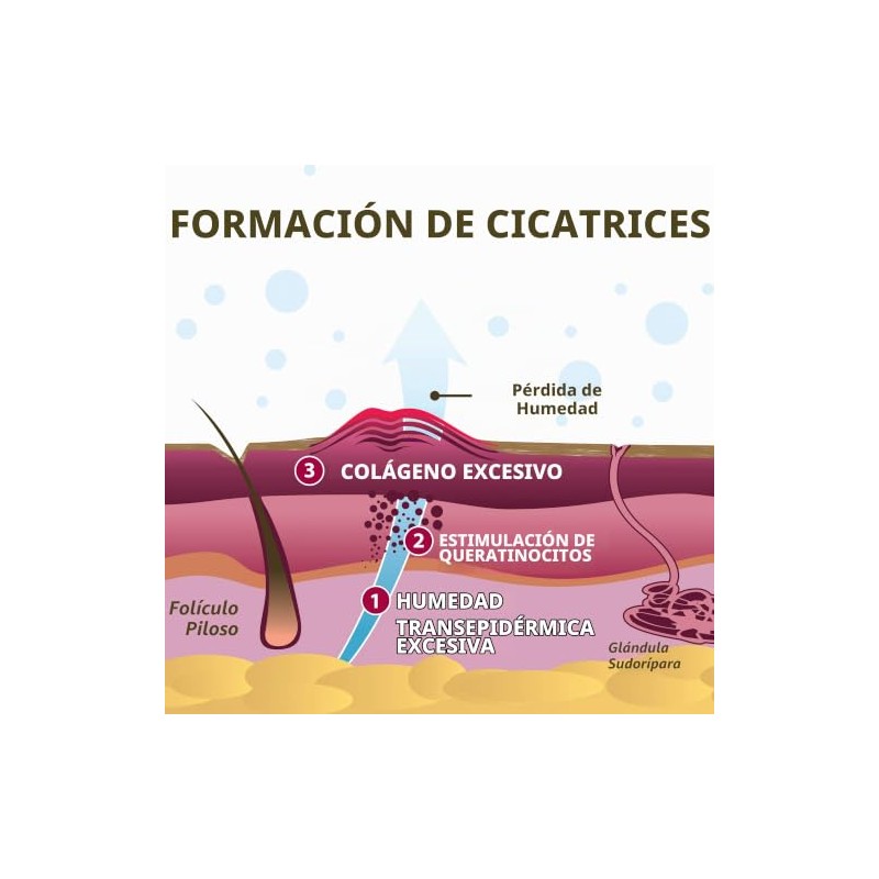 Scar Aid - Barra de silicona para tratamiento de cicatrices,