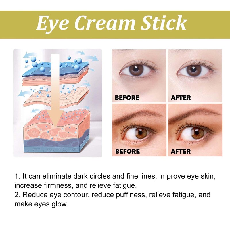 Eye Cream