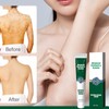 2pcs Hydrating Moisturizing Cream Eczema Erythema Repair Cream Itchy Skin