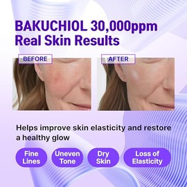 CELDYQUE Concentrado de bakuchiol coreano, mezcla casera en suero, 30 000 ppm, alternativa al retinol de alta potencia, reducción de arrugas, reafirmación y suavizado de la piel, antienvejecimiento, piel