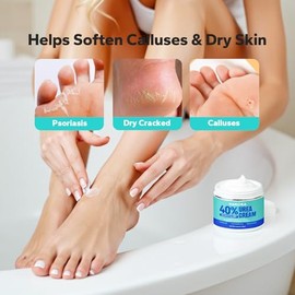 Crema de urea (5.29 onzas), crema de urea al 40 por ciento con ácido salicílico al 2%, crema de pies para talones y pies agrietados secos, para exfoli