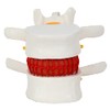 Axis Scientific Human Lumbar Herniating Disc Demonstration Anatomy Model for