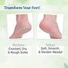 Softsoles Intensive Foot care cream Combo Pack of 4 (30g