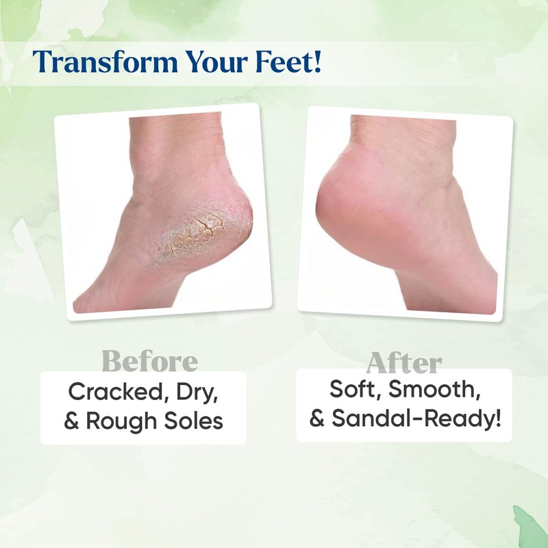Softsoles Intensive Foot care cream Combo Pack of 4 (30g