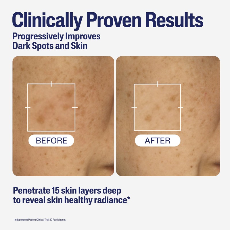 Cetaphil Healthy Radiance Brightening Serum with Niacinamide for Skin Pigmentation,