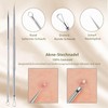 Blackhead Remover Set, High-Quality Stainless Steel Comedone Squeezer, Acne, Whiteheads,