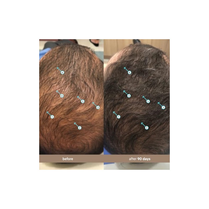 DS Labs Spectral.DNC-N Hair Redensifying Hair Therapy 60 Milliliter