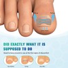 FERYES 50 PCS Breathable Ingrown Toenail Corrector Patch with Double-Ended
