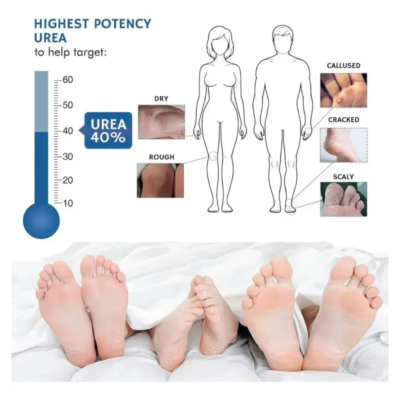 // Crema Con Urea Al 40% For Obtener Resultados En