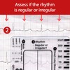 Transparent ECG ruler/card, Ecg 7 Step Ruler, Portable Ecg Ruler